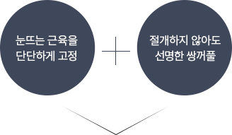 비절개 눈매교정
