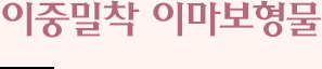 이중밀착 이마보형물