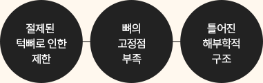 양악재수술이 어려운 이유