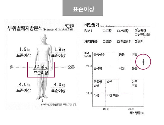 표준이상
