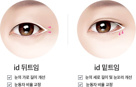 듀얼 트임