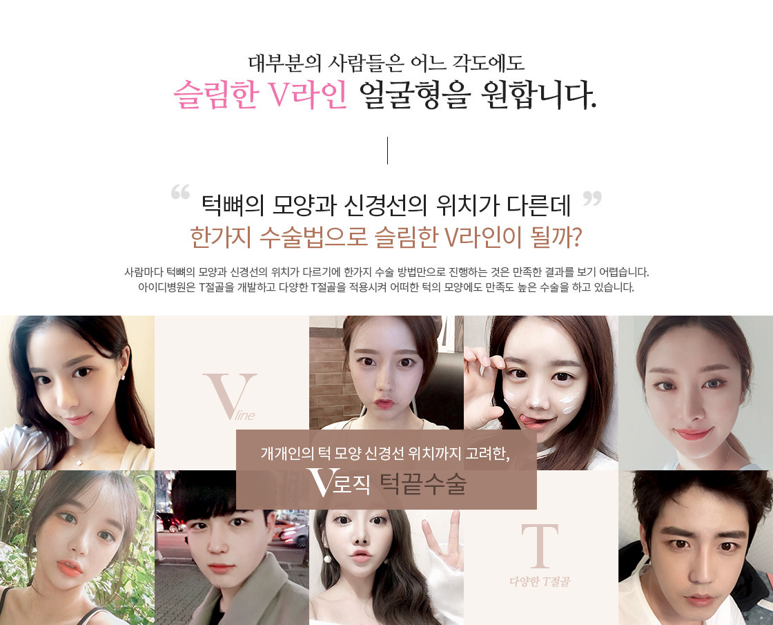 개개인의 턱 모양 신경선 위치까지 고려한 v로직 턱끝수술